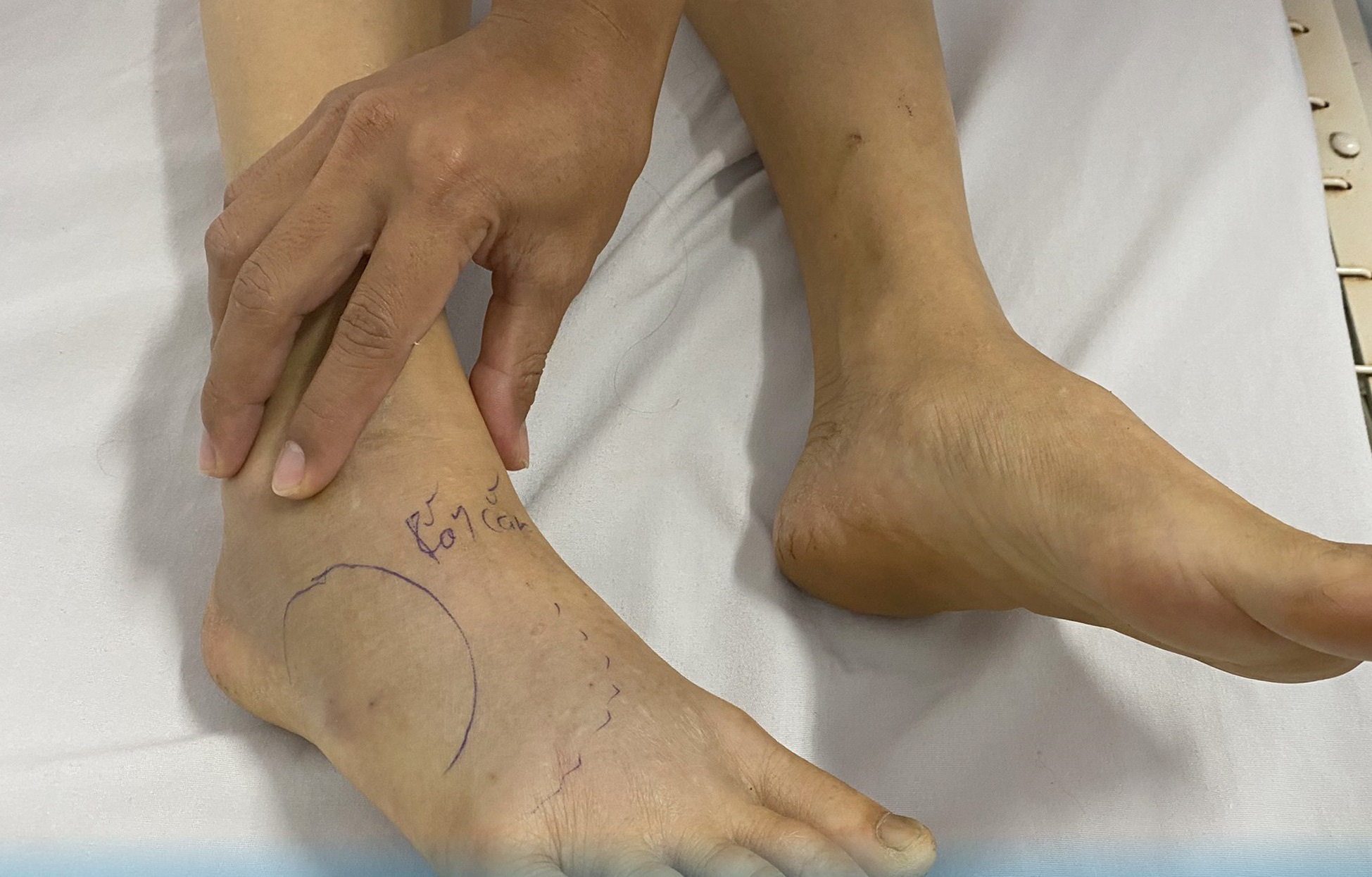 răn cắn vào chân là số mấy